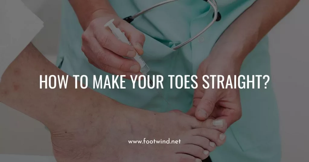 How To Make Your Toes Straight